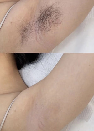 A315608ef5680416c8de8cc91426c860cO.png